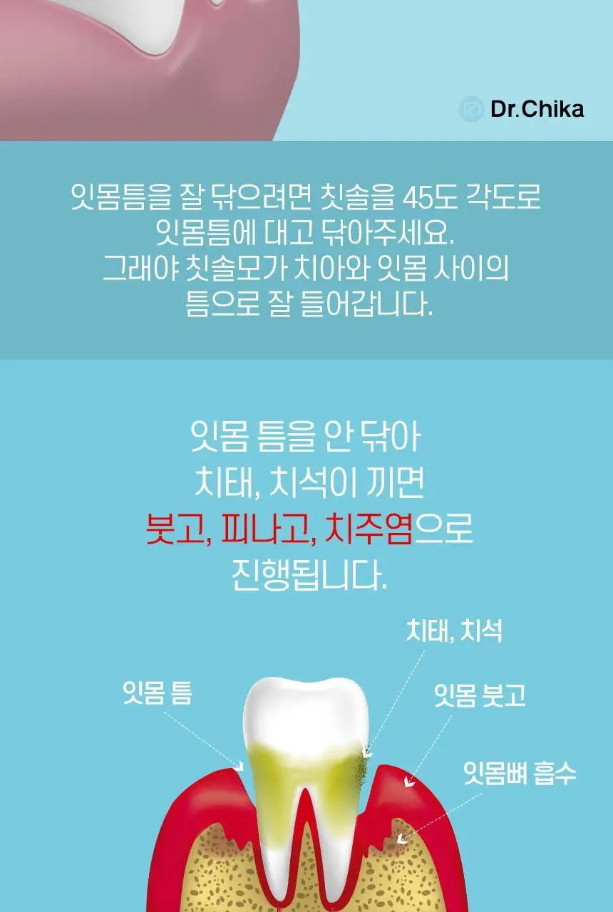 [고불소] 닥터치카 고불소 여행용 치약 칫솔 세트 상세페이지 43